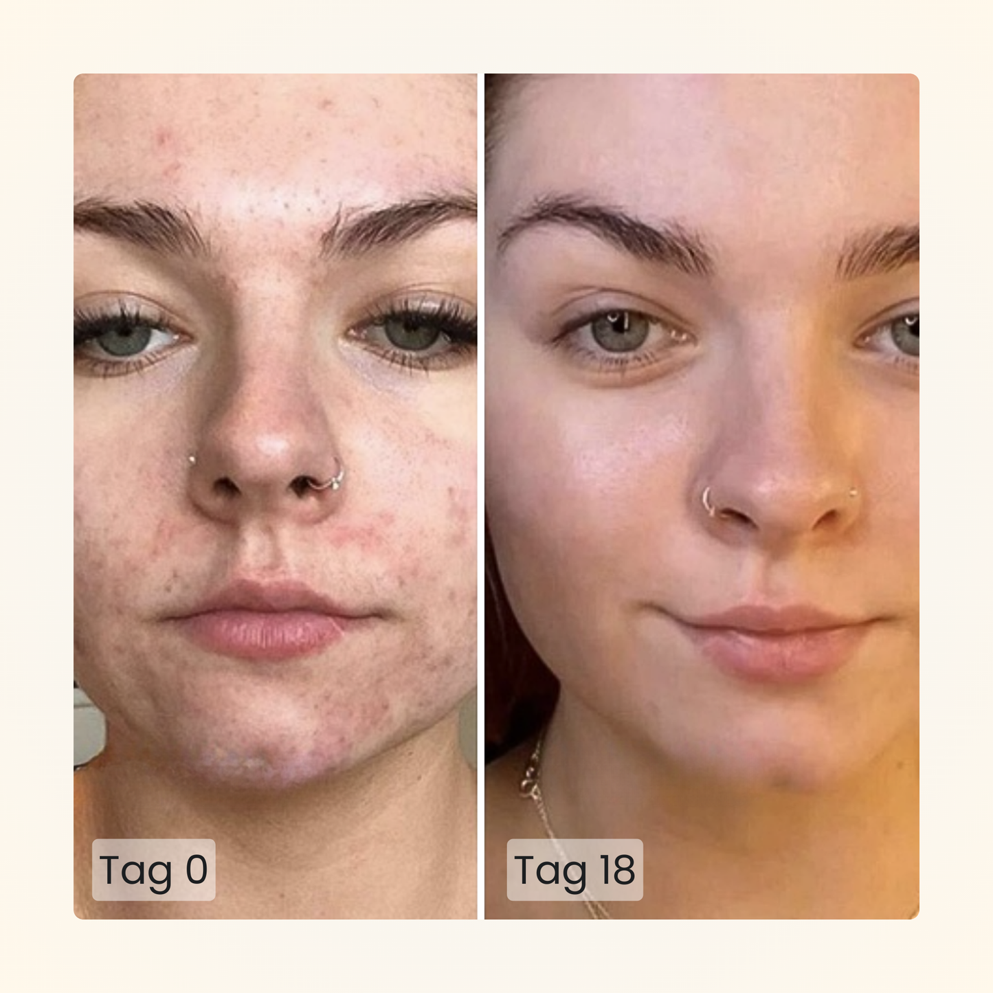 Gloomi® Skin Essence Bar (2er Pack)