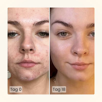 Gloomi® Skin Essence Bar (2er Pack)