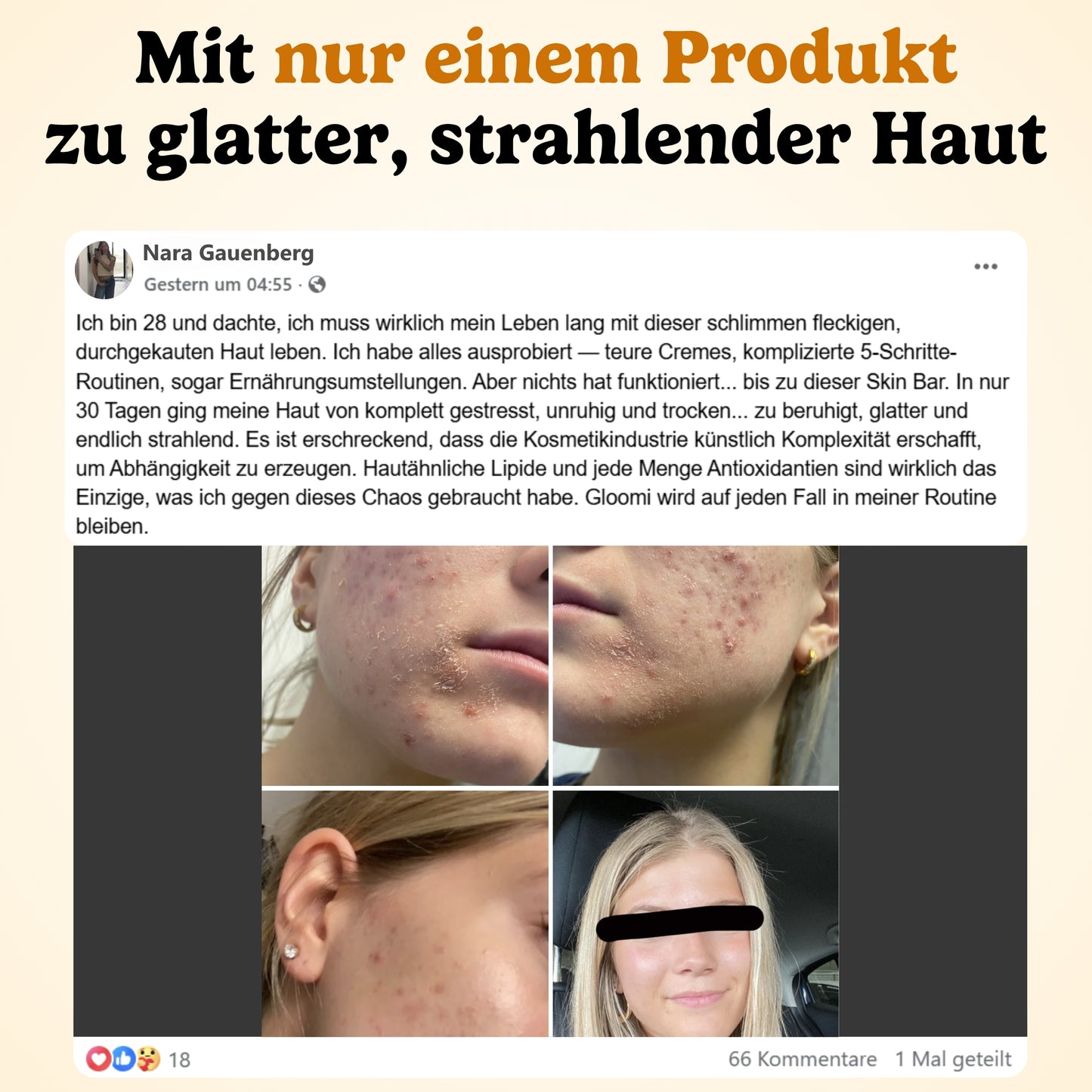 Gloomi® Skin Essence Bar (2er Pack)