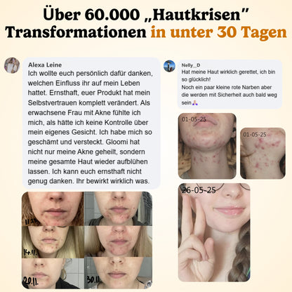 Gloomi® Skin Essence Bar (2er Pack)